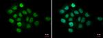 MTA1 Antibody in Immunocytochemistry (ICC/IF)