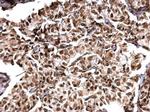 MTA1 Antibody in Immunohistochemistry (Paraffin) (IHC (P))