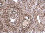 MTA1 Antibody in Immunohistochemistry (Paraffin) (IHC (P))