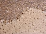 MTA1 Antibody in Immunohistochemistry (Paraffin) (IHC (P))