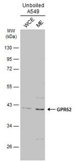 GPR52 Antibody in Western Blot (WB)