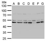 LHX2 Antibody in Western Blot (WB)