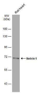 NTN1 Antibody in Western Blot (WB)