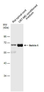 NTN1 Antibody in Western Blot (WB)