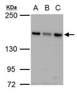 ROCK2 Antibody in Western Blot (WB)