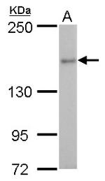 ROCK2 Antibody in Western Blot (WB)