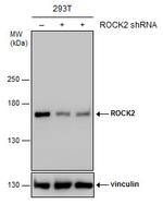 ROCK2 Antibody