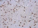 SETD1A Antibody in Immunohistochemistry (Paraffin) (IHC (P))