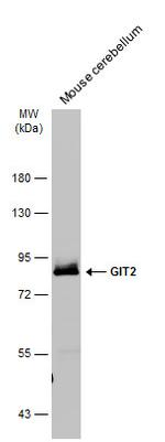 GIT2 Antibody in Western Blot (WB)