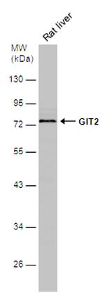 GIT2 Antibody in Western Blot (WB)