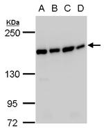 SMC4 Antibody in Western Blot (WB)