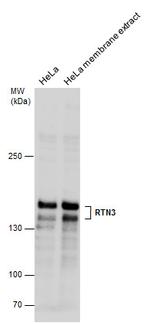 RTN3 Antibody in Western Blot (WB)