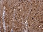 SEMA3A Antibody in Immunohistochemistry (Paraffin) (IHC (P))