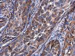 BASP1 Antibody in Immunohistochemistry (Paraffin) (IHC (P))