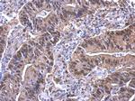 YAP1 Antibody in Immunohistochemistry (Paraffin) (IHC (P))