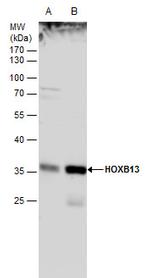 HOXB13 Antibody in Western Blot (WB)