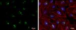 RNAse H2A Antibody in Immunocytochemistry (ICC/IF)