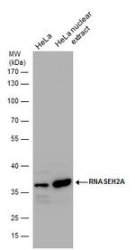 RNAse H2A Antibody in Western Blot (WB)