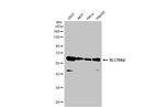 SLC19A2 Antibody in Western Blot (WB)