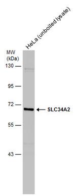 SLC34A2 Antibody in Western Blot (WB)