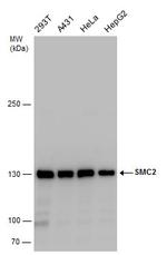 SMC2 Antibody in Western Blot (WB)