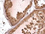 RBCK1 Antibody in Immunohistochemistry (Paraffin) (IHC (P))