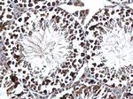 RUVBL2 Antibody in Immunohistochemistry (Paraffin) (IHC (P))