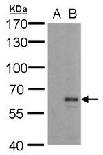 MMP24 Antibody in Western Blot (WB)