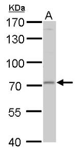 MMP24 Antibody in Western Blot (WB)