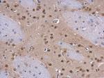 COPS8 Antibody in Immunohistochemistry (Paraffin) (IHC (P))