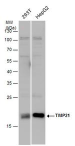 TMP21 Antibody in Western Blot (WB)