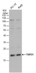 TMP21 Antibody in Western Blot (WB)