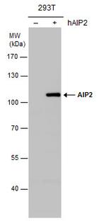 AIP2 Antibody in Western Blot (WB)