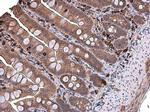 Coronin 1A Antibody in Immunohistochemistry (Paraffin) (IHC (P))