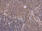 Coronin 1A Antibody in Immunohistochemistry (Paraffin) (IHC (P))