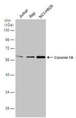 Coronin 1A Antibody in Western Blot (WB)