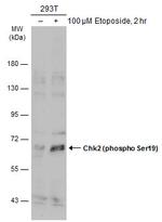 Phospho-CHK2 (Ser19) Antibody in Western Blot (WB)