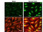 Phospho-CHK2 (Thr68) Antibody in Immunocytochemistry (ICC/IF)