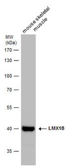 LMX1B Antibody in Western Blot (WB)