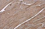 MYL2 Antibody in Immunohistochemistry (Paraffin) (IHC (P))