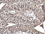 ODF2 Antibody in Immunohistochemistry (Paraffin) (IHC (P))