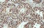 Brachyury Antibody in Immunohistochemistry (Paraffin) (IHC (P))