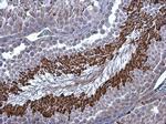 Brachyury Antibody in Immunohistochemistry (Paraffin) (IHC (P))