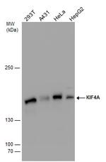 KIF4A Antibody in Western Blot (WB)