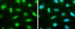 TRMT2A Antibody in Immunocytochemistry (ICC/IF)