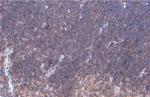 LAT Antibody in Immunohistochemistry (Paraffin) (IHC (P))