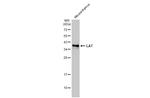 LAT Antibody in Western Blot (WB)