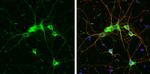 GIT1 Antibody in Immunocytochemistry (ICC/IF)