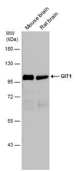 GIT1 Antibody in Western Blot (WB)