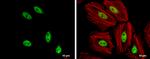 SOX8 Antibody in Immunocytochemistry (ICC/IF)